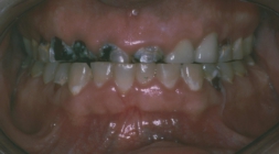 Comprehensive Dentistry - Before