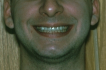 Comprehensive Dentistry - After Portrait